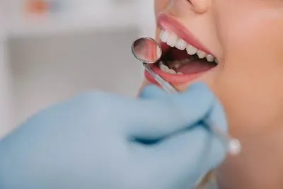 patient getting a dental checkup at Smile Source North