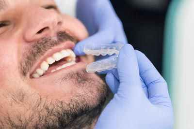 patient getting his new Invisalign clear aligners from Smile Source North