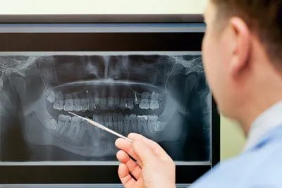 Dr. Henneberg reviewing a patient's dental x-rays