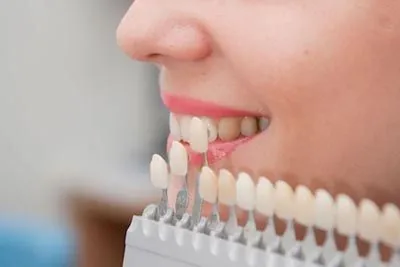 patient picking a color for their dental veneers