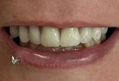 After image