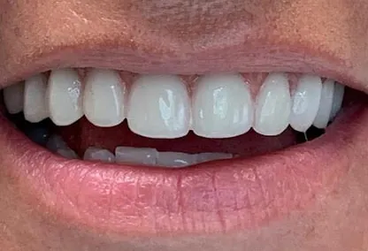 After image