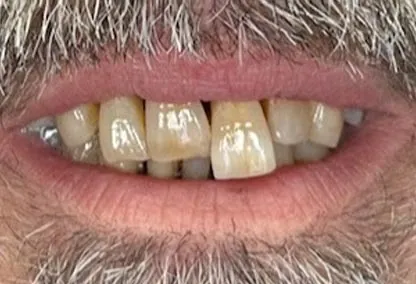 Before image