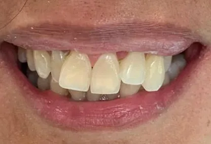 Before image