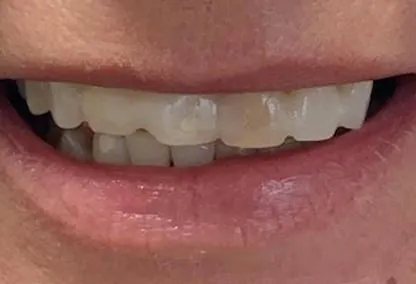 Before image
